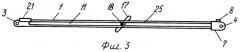 Медицинский инструмент для определения проекции нерва при проводниковых блокадах (патент 2408321)