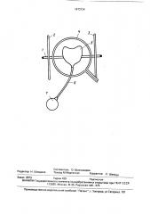 Устройство для электромагнитного воздействия на тело матки (патент 1673134)