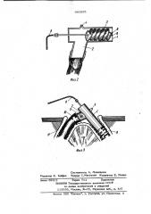Обтуратор для свищей желудочно-кишечного тракта (патент 993955)