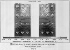 Способ комбинированной термометрии для диагностики посттромботической болезни вен нижних конечностей (патент 2319438)