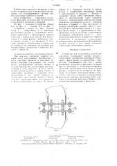Устройство для остеосинтеза костей при переломах (патент 1519689)