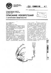 Способ аутотрансплантации надпочечника (патент 1560116)