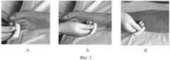 Способ интраоперационного прогнозирования эффекта опосредованной реваскуляризации у больных с хронической ишемией нижних конечностей (патент 2449732)