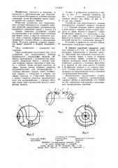 Устройство для хирургического лечения близорукости (патент 1114417)