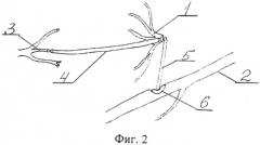 Способ устранения паралича мимических мышц (патент 2566215)