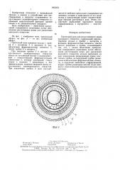 Протезный жом для искусственного заднепроходного отверстия (патент 1463254)