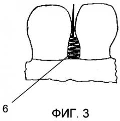 Лента для чистки межзубного пространства и способ чистки межзубного пространства этой лентой (патент 2313309)