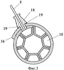 Регулируемое бандажное устройство для желудка (патент 2364374)