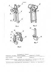 Соединение деталей (патент 1455076)