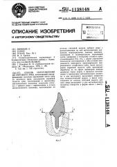 Способ изготовления штифтового зуба (патент 1138148)