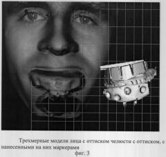 Способ построения трехмерного изображения лица и зубных рядов, сопоставленных в корректном друг относительно друга положении (патент 2306113)