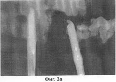Заливочная композиция для стимуляции образования кости и сращения кости, содержащая сульфат кальция и вязкие биополимеры (патент 2296588)