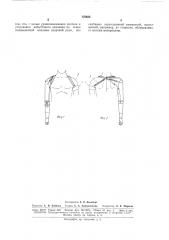 Устройство для фиксации протеза плеча при односторонней ампутации (патент 170622) Устройство для фиксации протеза плеча при односторонней ампутации (патент 170622)