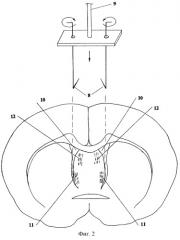 Способ моделирования патологии проводящих путей гиппокампа (патент 2258961)