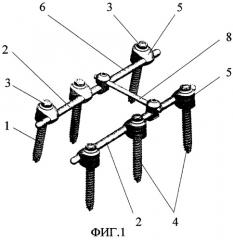 Спинальное устройство, преимущественно для соединительных штанг (патент 2301040)