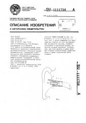 Ушной вкладыш (патент 1111754)