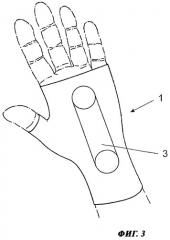 Ортопедическое вспомогательное устройство с закладным функциональным элементом (патент 2459603)