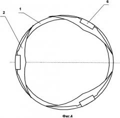 Протез клапана сердца (патент 2477105)