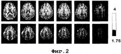 Функциональная визуализация головного мозга для обнаружения и оценки обмана и скрытого признания, и когнитивной/эмоциональной реакции на информацию (патент 2296508)