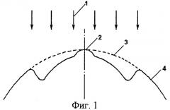 Способ хирургической коррекции пресбиопии в сочетании с простым гиперметропическим астигматизмом (патент 2306913)