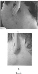 Способ терапии и контроля за процессом лечения рубцов, возникающих вследствие угревой сыпи (acne vulgaris) (патент 2252796)