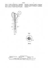 Ножка эндопротеза сустава (патент 1630811)