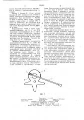 Способ лечения остеохондроза поясничного отдела позвоночника (патент 1148611)