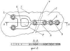 Компрессионная мини-пластина для остеосинтеза нижней челюсти, способ ее установки и набор инструментов для установки (патент 2403882)