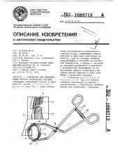 Устройство для моделирования стеноза кровеносных сосудов (патент 1088713)