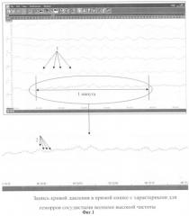 Способ ранней диагностики геморроя (патент 2341187)