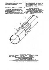 Устройство для лечения переломов (патент 891083)