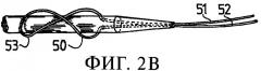 Способ крепления натяжных нитей к концам протезной связки (патент 2370243)