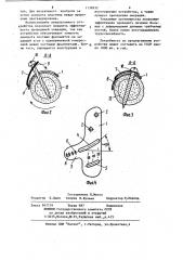 Устройство для компрессионного остеосинтеза (патент 1130332)