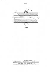 Чрескостный фиксатор для остеосинтеза (патент 1431749)
