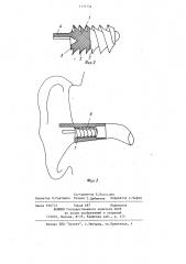 Ушной вкладыш (патент 1111754)