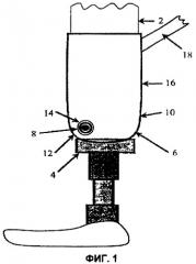 Удаляемый клапанный узел (патент 2360171)