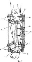 Аппарат для лечения больных с сочетанными повреждениями голени и стопы (патент 2476181)