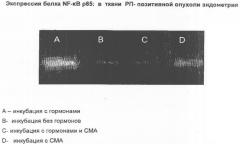 Применение 9-оксоакридин-10-уксусной кислоты и/или ее соли в комбинации с антиэстрогеном и/или прогестином для лечения эстрогензависимых опухолей, способ лечения и наборы (патент 2346691)