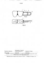 Мостовидный протез (патент 1651888)
