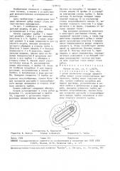 Канюля (патент 1570713)