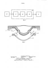 Вибромассажное устройство (патент 1000029)