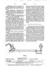 Устройство для лечения переломов бедра (патент 1616635)