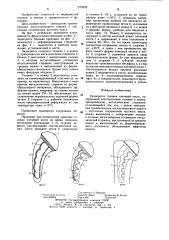 Эндопротез головки плечевой кости (патент 1279629)