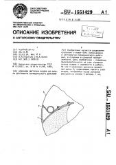 Механизм выгрузки осадка из ротора центрифуги периодического действия (патент 1551429)