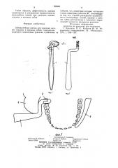 Зубоврачебные щипцы для удаления нижних седьмых и восьмых зубов (патент 936906)