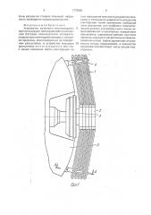 Устройство зачековки многосекционной конструкции (патент 1773806)