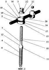 Устройство для проведения стабилизирующей операции на позвоночнике (его варианты) и способ проведения стабилизирующей операции на позвоночнике (патент 2285483)
