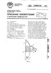 Устройство для исследования стекловидного тела глаза (патент 1449110)