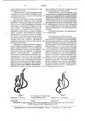 Способ формирования магнитного компрессионного холецистогастроанастомоза (патент 1708313)