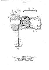 Способ профилактики послеоперационных артрогенных контрактур и устройство для его осуществления (патент 1124945)